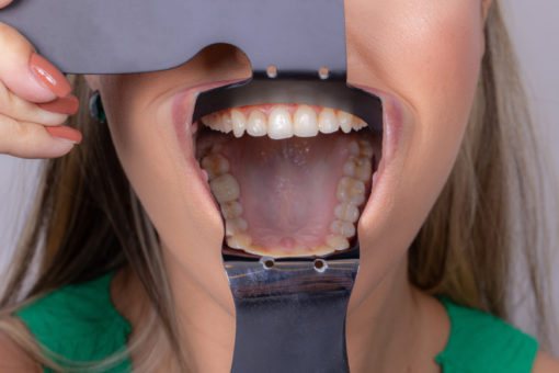 ESPEJO PARA FOTO METALICO INDUSBELLO - Imagen 2